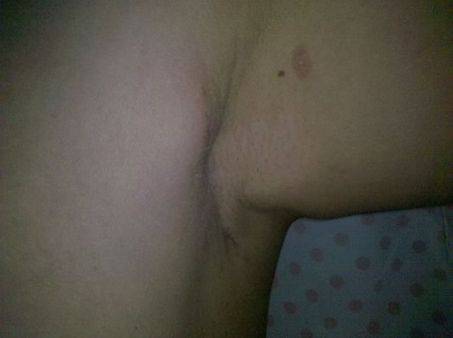 2 meses después